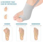 Bunion Corrector & Separator Pads for Pain Relief