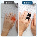 Adjustable Finger Splint for Injury and Support