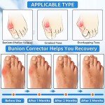Adjustable Bunion Corrector Splint for Pain Relief