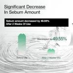 Anua Heartleaf Soothing Toner for Skin Care