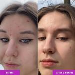 Good Molecules 10% Niacinamide Vegan Facial Serum