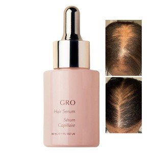 Vegamour GRO Hair Serum for Thicker, Healthier Growth