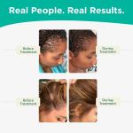 Vegan Thickening Shampoo for Hair Loss Treatment