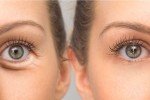 Vegan Hyaluronic Acid & Vitamin C Eye Serum