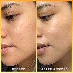 30% Vitamin C Serum with Ferulic & Hyaluronic Acid