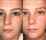 30% Vitamin C Serum with Ferulic & Hyaluronic Acid