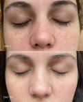 30% Vitamin C Serum with Ferulic & Hyaluronic Acid