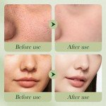 Avocado Skincare Set: 6-Piece Hydrating Kit