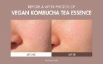 Korean Vegan Kombucha Tea Skincare Gift Set