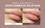 Korean Vegan Kombucha Tea Skincare Gift Set