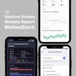 Flowtime Meditation Headband: Neurofeedback for Home Use