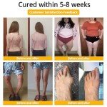 Bee Venom Pain Relief Cream for Joints