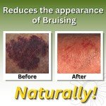 Arnica Pain Relief Cream with Essential Oils