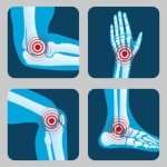 Intense Cooling Pain Relief Gel for Muscles & Joints