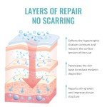 Scar Cream Gel for Surgical Scars & More