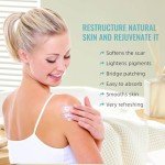 Scar Cream Gel for Surgical Scars & More