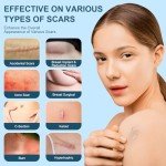 Silicone Scar Gel for Old & New Scars