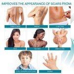 Advanced Silicone Scar Gel with Vitamin E, 15g