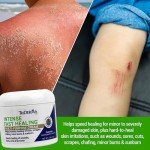 TriDerma Fast Healing Cream for Skin Irritations