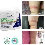 TriDerma Fast Healing Cream for Skin Irritations