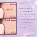 Cicatricure Gel for Scars and Stretch Marks
