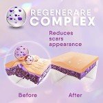 Cicatricure Gel for Scars and Stretch Marks