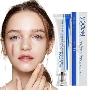 Advanced Scar Removal Cream for Face and Body