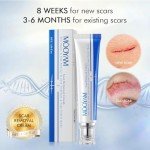 Advanced Scar Removal Cream for Face and Body