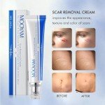 Advanced Scar Removal Cream for Face and Body