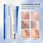 Advanced Scar Removal Cream for Face and Body