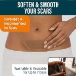 Silicone Patches for Scar Reduction – 14.5 x 4 cm