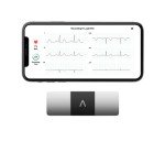 Kardiamobile 6L Wireless 6-Lead EKG Device
