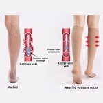 Knee-High Compression Socks for Varicose Veins