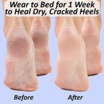 Moisturizing Heel Socks for Dry Cracked Feet