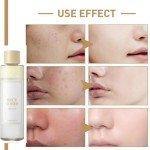 Hydrating Rice Toner for Dry Skin 150ml