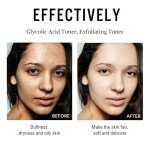 Rice Water Toner for Hydrating Glowing Skin