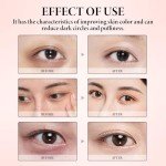 Retinol Eye Cream for Dark Circles & Puffiness