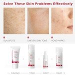 Niacinamide Skincare Set for Bright, Even Skin