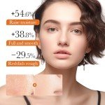 Rice Toner for Hydration and Even Skin Tone