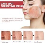 Peach Niacinamide Serum for Dark Spots and Scars