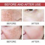 Peach Niacinamide Serum for Dark Spots and Scars
