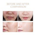 Gentle Exfoliating Gel Cleanser for Clear Skin