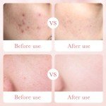 Rose Water Facial Toner for Smooth Hydration