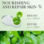 Centella Gel Cream for Acne-Prone Skin