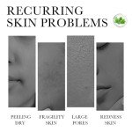 Centella Gel Cream for Acne-Prone Skin