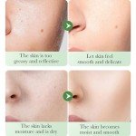 Centella Gel Cream for Acne-Prone Skin