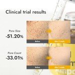 MIZON Real Vitamin C Ampoule - Brightening Serum