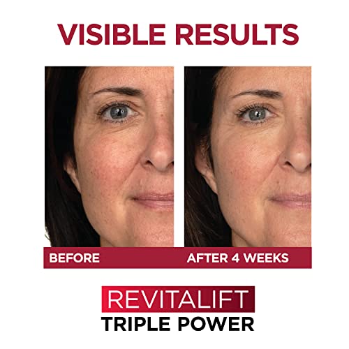 L'Oreal Paris Revitalift Triple Power Anti-Aging Face Moisturizer & Hyaluronic Acid Face Serum, Paraben & Fragrance Free Regimen Kit, 2 Count