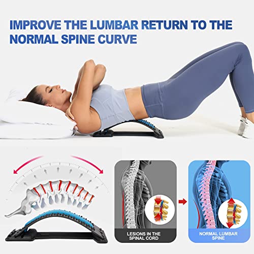 Back Stretching Device,Back Massager for Bed & Chair & Car,Multi-Level Lumbar Support Stretcher Spinal, Lower and Upper Muscle Pain Relief(Black/Blue)