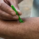 TickCheck Tick Remover 3 Pack with Identification Card